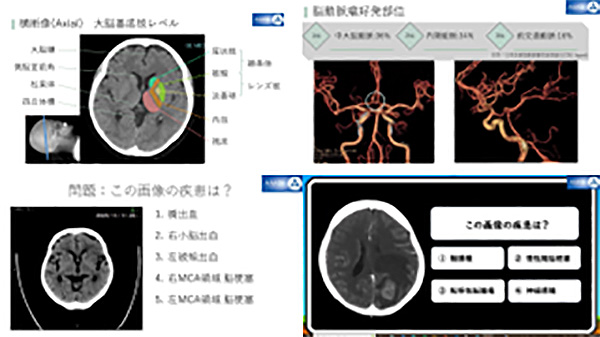 第36回AMG放射線部 CT技術研究会