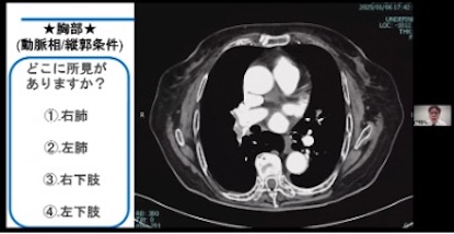 第38回AMG放射線部 CT技術研究会